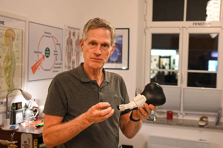 BuniCure Bunion Correction Before and After